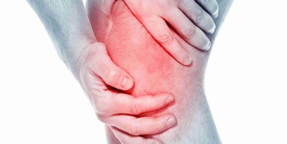 La douleur dans un genou plié ou droit est un symptôme de l'arthrose de l'articulation du genou