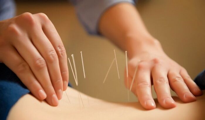 l'acupuncture pour traiter les douleurs lombaires